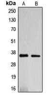 DNAJC17 Antibody (N-Terminus)