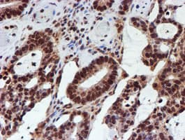 CYP17 / CYP17A1 Antibody (clone OTI3F11)