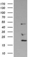 IHC-plus™ Monoclonal Mouse anti-Human DDX39B / UAP56 Antibody (clone 2E4, IHC, IF, WB)