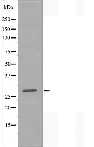 BCAP31 / BAP31 Antibody