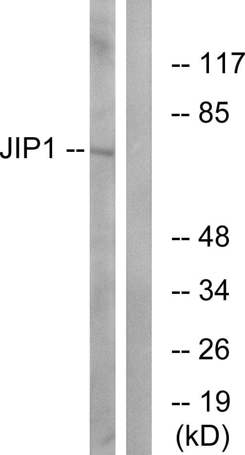 Polyclonal Rabbit anti-Human MAPK8IP1 / JIP1 Antibody (p103, IHC, IF, WB)