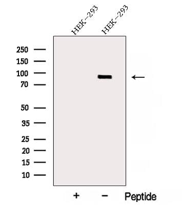 Polyclonal Rabbit anti-Human ARHGAP10 Antibody (IF, WB)