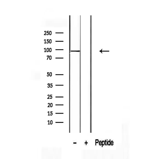 TCTN2 Antibody