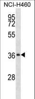 SERPINB1 Antibody (aa168-196)