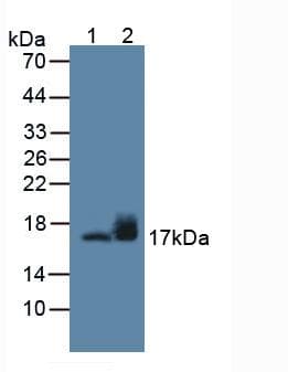 SNCG / Gamma-Synuclein Antibody (aa1-123)