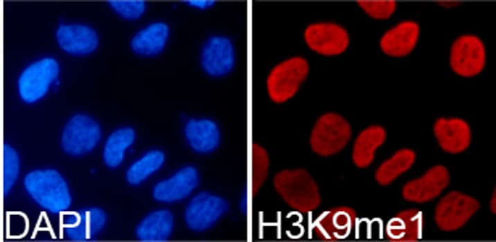 Polyclonal Rabbit anti-Human Histone H3 Antibody (Methyl-Lys9, IHC, IF, WB)