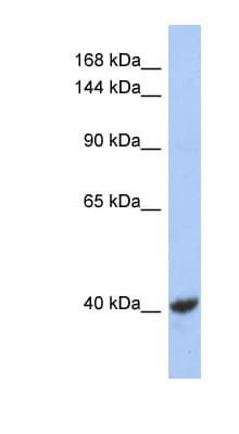 Polyclonal Rabbit anti-Human KCNQ2 Antibody (aa179-228, IHC, WB)