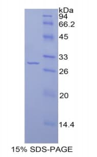 Rat IRAK2 / IRAK-2 Protein (Recombinant His)
