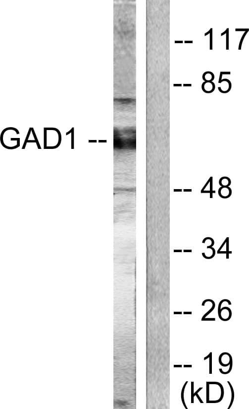 IHC-plus™ GAD / Glutamate Decarboxylase Antibody (aa545-594)
