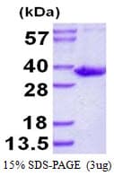 Human SULT1B1 / Sulfotransferase 1B1 Protein (Recombinant His)