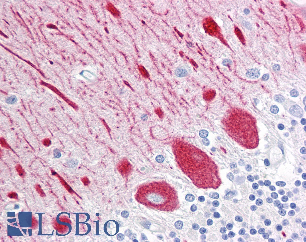 IHC-plus™ RTN1 / Reticulon 1 Antibody (clone RNL-3)