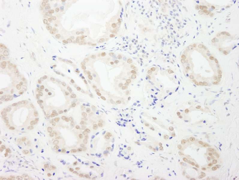 GTF3C4 Antibody (aa625-675)