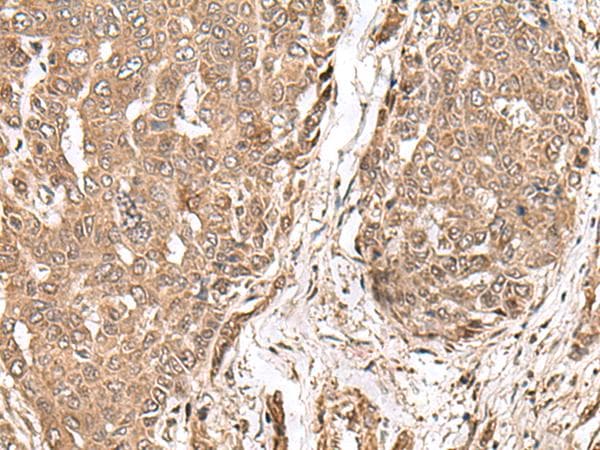 MAGOHB / Mago Antibody