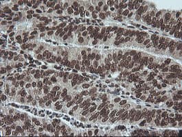 Monoclonal Mouse anti-Human MAPK3 / ERK1 Antibody (clone OTI4D7, IHC, IF, WB)