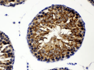 CCT8 Antibody