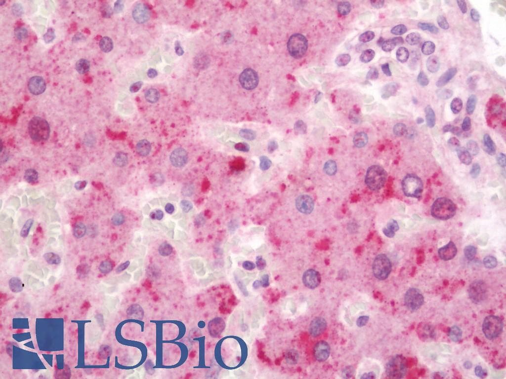 IHC-plus™ ANGPTL3 Antibody