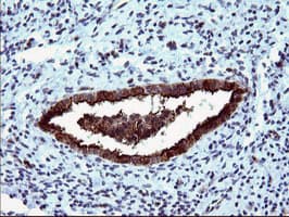 Monoclonal Mouse anti-Human MLANA / Melan-A Antibody (clone OTI2G2, IHC, IF, WB)