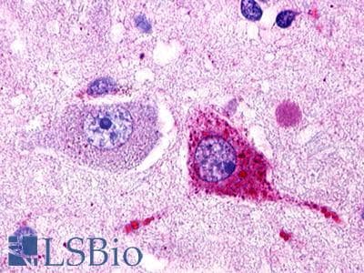 PathPlus™ GPR174 Antibody (Extracellular Domain)