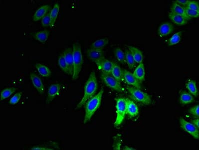 IHC-plus™ RPLP1 Antibody