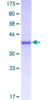 Human ADAMTS8 Protein (Recombinant GST, N-terminus)