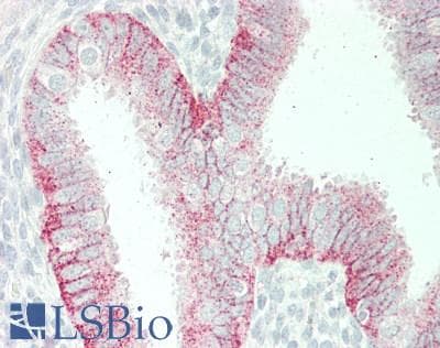 IHC-plus™ Polyclonal Rabbit anti-Human CMTM6 / CKLFSF6 Antibody (IHC, WB)