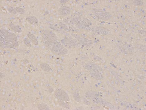 IHC-plus™ DDX / AKR1C3 Antibody