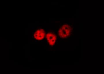 Polyclonal Rabbit anti-Human NFKB1 / NF-Kappa-B Antibody (phospho-Ser893, IHC, IF, WB)
