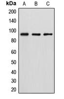 Polyclonal Rabbit anti-Human DGKB / DGK Beta Antibody (C-Terminus, WB)
