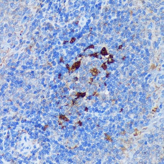 PADI4 / PAD4 Antibody