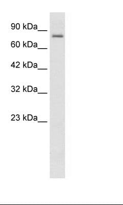 KCNN3 / SK3 Antibody (aa642-691)
