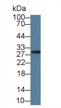 GSTM4-4 / GSTM4 Antibody (aa21-215)