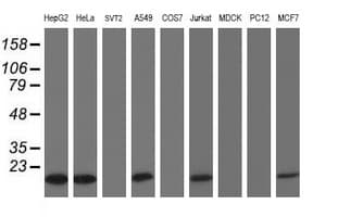 Monoclonal Mouse anti-Human COMMD1 Antibody (clone OTI1C3, IHC, WB)