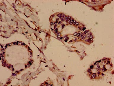 Polyclonal Rabbit anti-Human EVC / DWF-1 Antibody (IHC, WB)