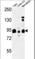SGIP1 Antibody (aa1-30)