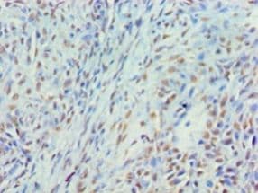 MYEF2 Antibody (aa372-576)