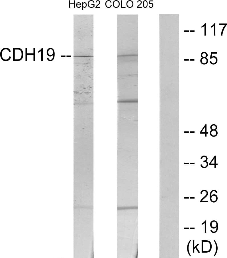 Polyclonal Rabbit anti-Human CDH19 / Cadherin 19 Antibody (aa371-420, WB)