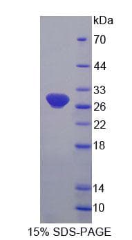 Human FBL / FIB / Fibrillarin Protein (Recombinant His-T7, N-terminus)