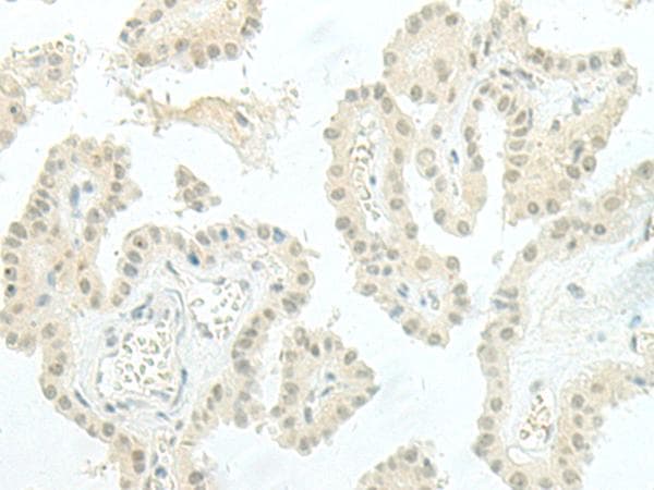 Polyclonal Rabbit anti-Human ESRP2 / RBM35B Antibody (IHC)