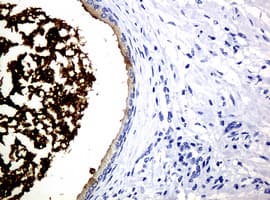 WFDC2 / HE4 Antibody (clone OTI1B9)