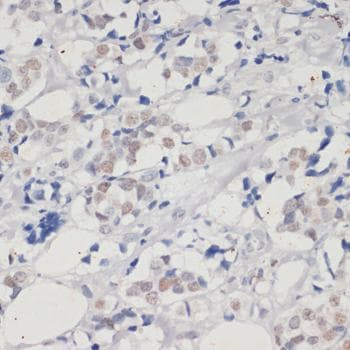 DNMT / DNMT1 Antibody