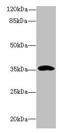 CCDC24 Antibody (Coiled-coil domain)