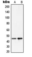 Polyclonal Rabbit anti-Human SERPINA5 / PCI Antibody (Internal, IHC, WB)