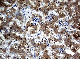 Alpha-Fetoprotein Antibody (clone UMAB66, Carrier-free)