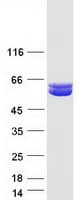 Human ALDH9A1 Protein (Recombinant Myc-DDK (Flag))
