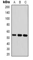 VTN / Vitronectin Antibody (Internal)