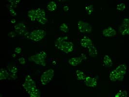 HK2 / Hexokinase 2 Antibody (clone OTI4C5)