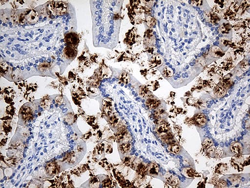 Monoclonal Mouse anti-Human TFF1 / pS2 Antibody (clone OTI1A4, aa25-84, IHC, WB)