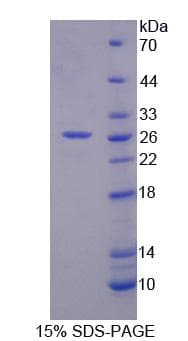 Human RFC4 Protein (Recombinant His, N-Terminal)