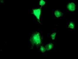 TMPRSS5 Antibody (clone OTI6E11)