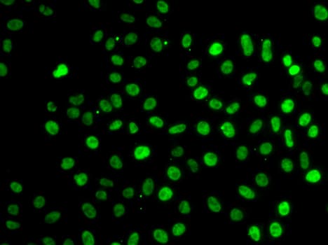 Polyclonal Rabbit anti-Human SF3B2 Antibody (IHC, IF, WB)